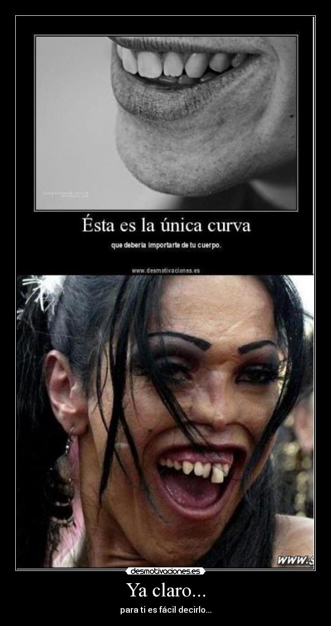 Ya claro... - para ti es fácil decirlo...