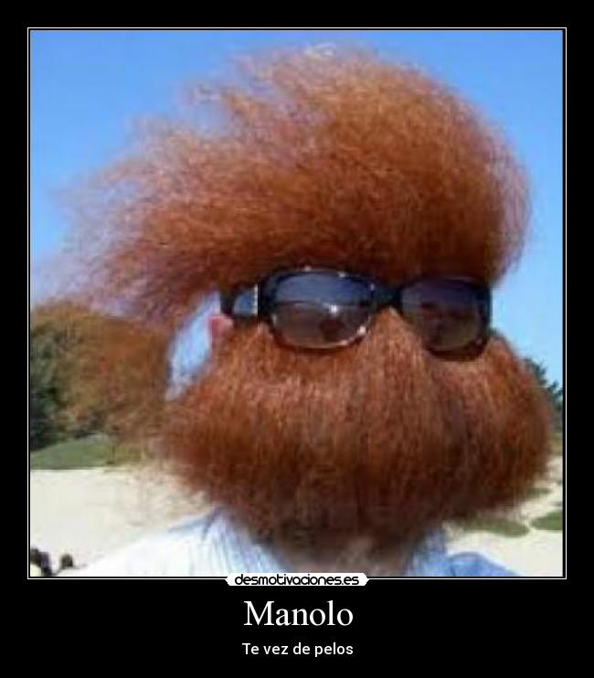 Manolo - Te vez de pelos