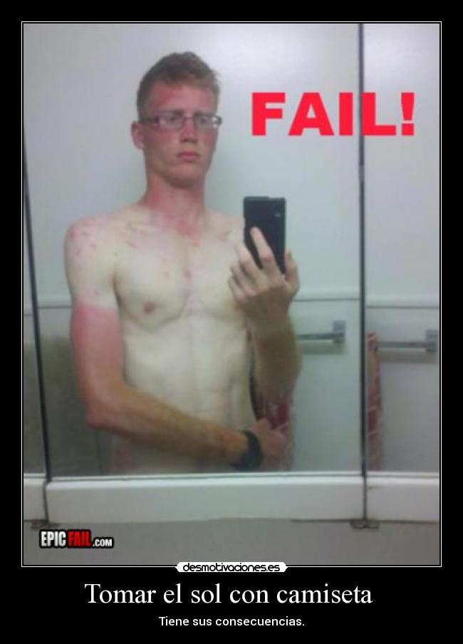 Tomar el sol con camiseta - Tiene sus consecuencias.