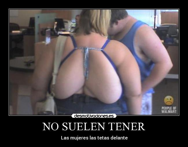 NO SUELEN TENER - 