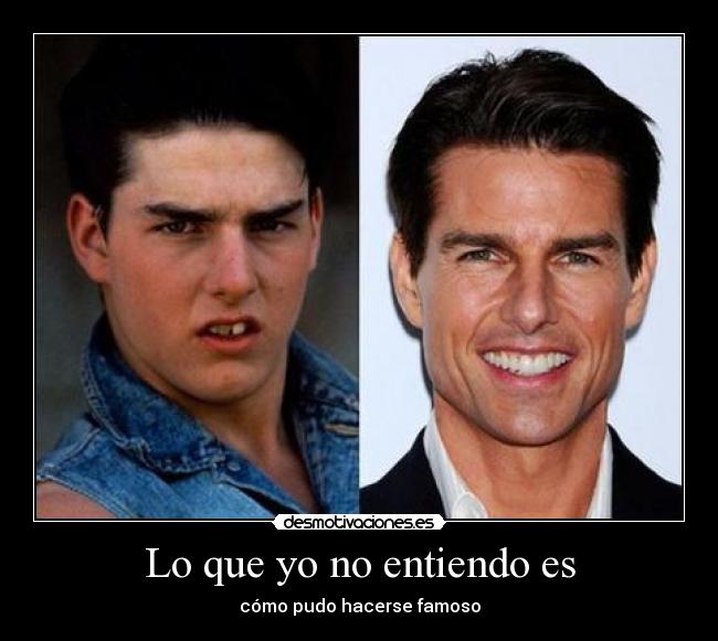 Lo que yo no entiendo es - cómo pudo hacerse famoso