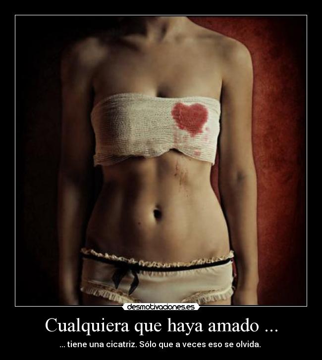 Cualquiera que haya amado ... - ... tiene una cicatriz. Sólo que a veces eso se olvida. 