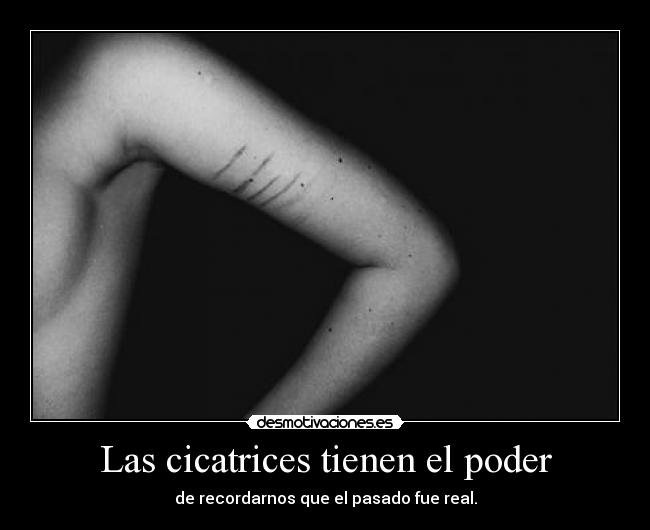 Las cicatrices tienen el poder -