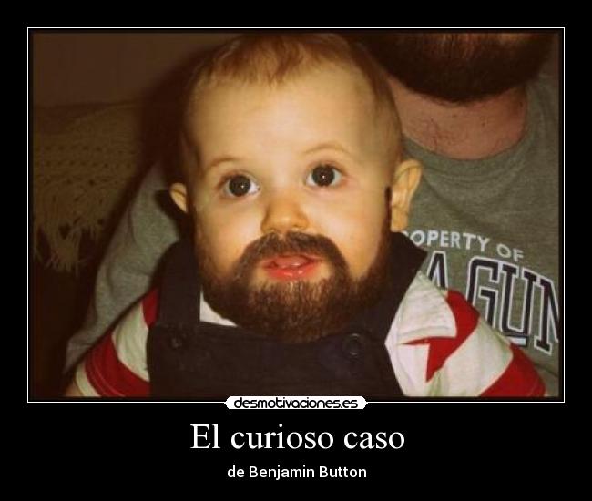 El curioso caso - 