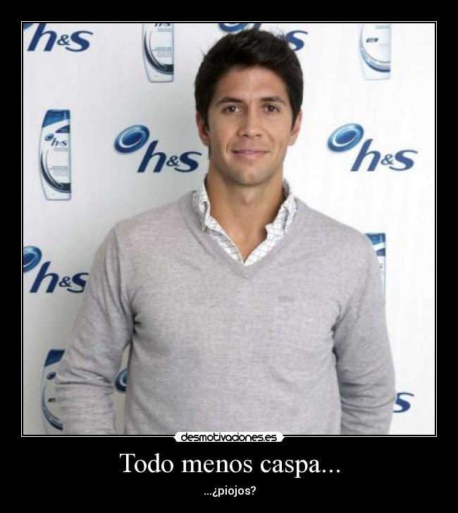 Todo menos caspa... -