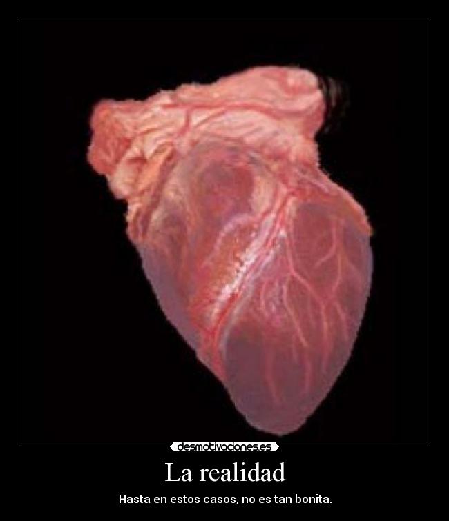 La realidad - Hasta en estos casos, no es tan bonita.