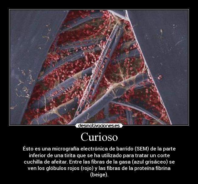 carteles cuirosidad globulos rojos tirita desmotivaciones