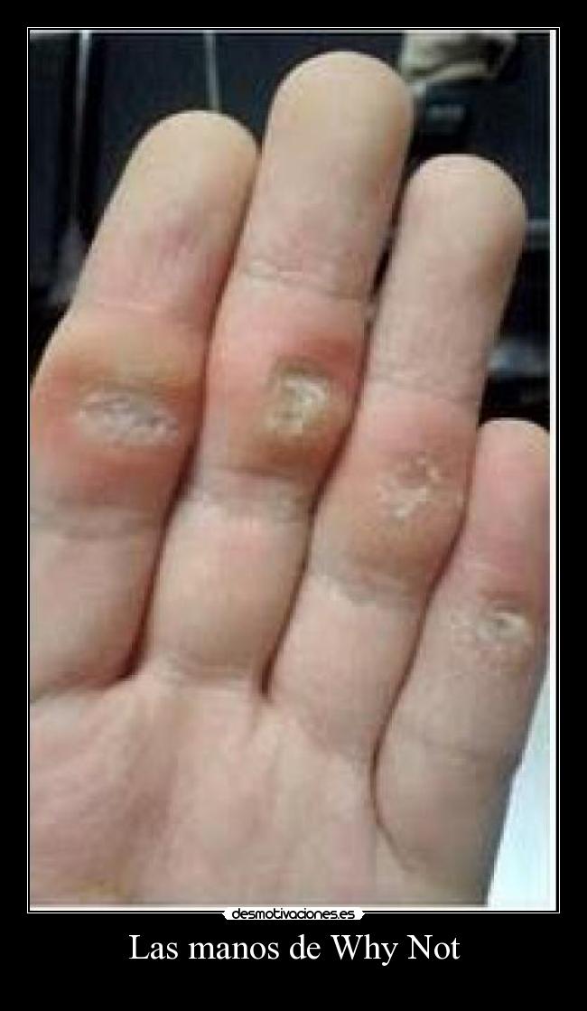 Las manos de Why Not -