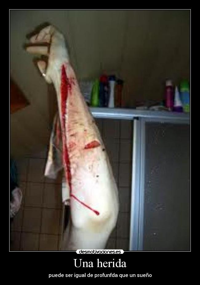 Una herida - puede ser igual de profunfda que un sueño