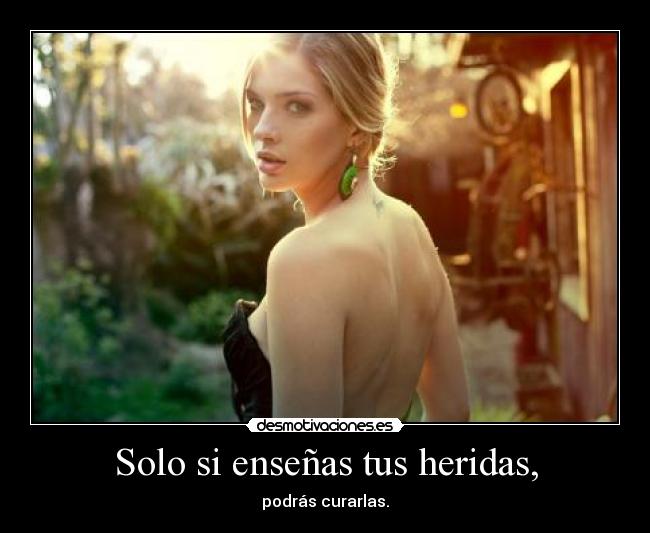 Solo si enseñas tus heridas, - 