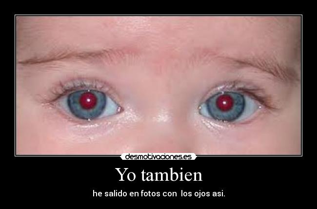 Yo tambien - he salido en fotos con  los ojos asi.