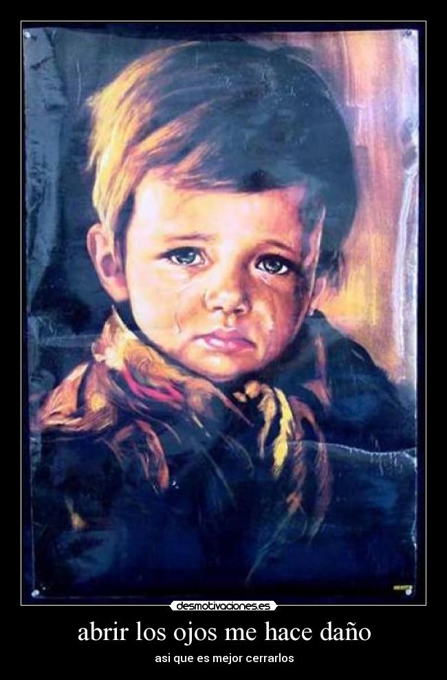 abrir los ojos me hace daño -