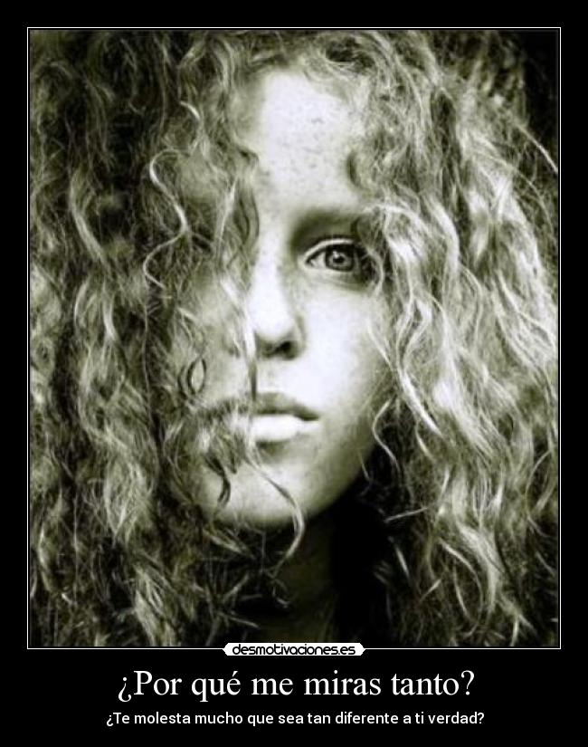 ¿Por qué me miras tanto? - ¿Te molesta mucho que sea tan diferente a ti verdad?