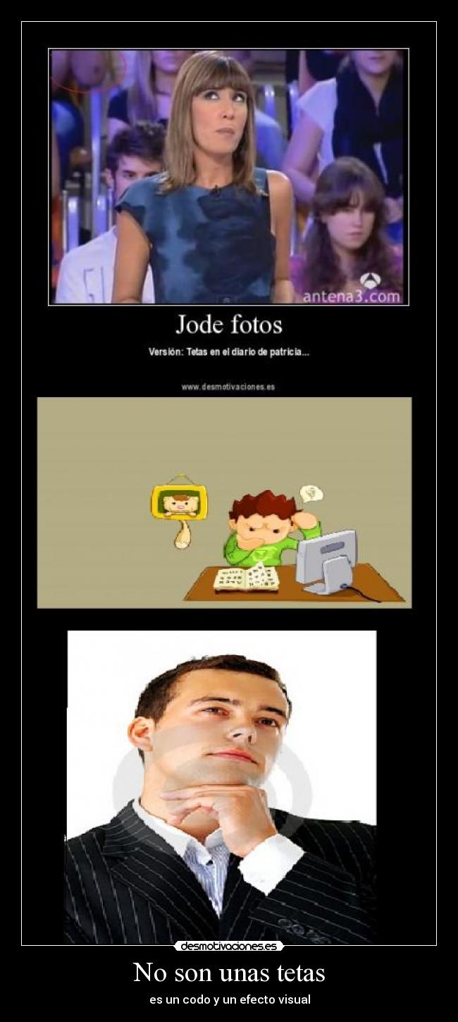 No son unas tetas -