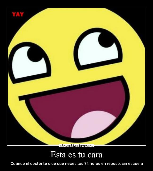 Esta es tu cara - Cuando el doctor te dice que necesitas 74 horas en reposo, sin escuela