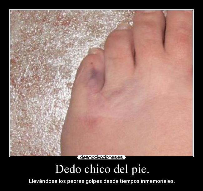 Dedo chico del pie. - 