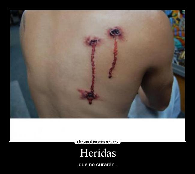 Heridas - 