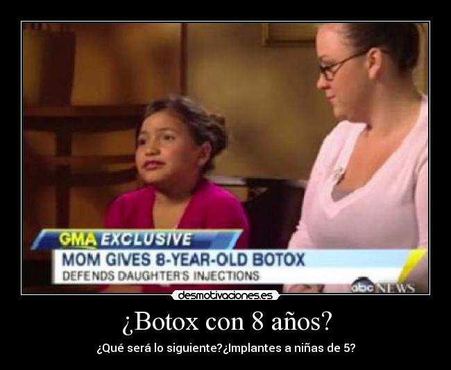 ¿Botox con 8 años? - 