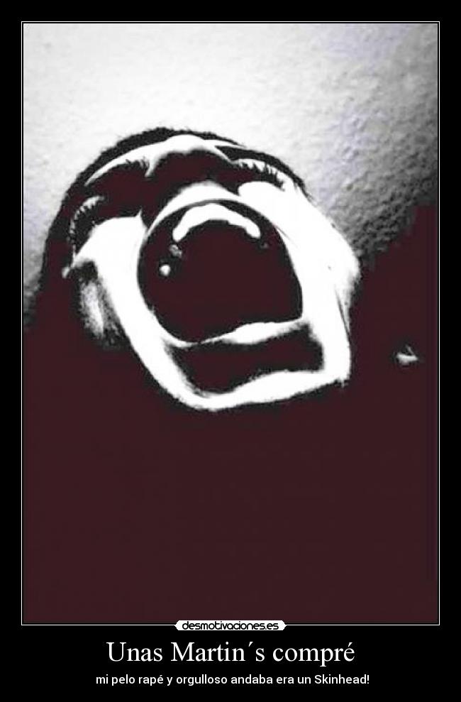 Unas Martin´s compré -  mi pelo rapé y orgulloso andaba era un Skinhead!