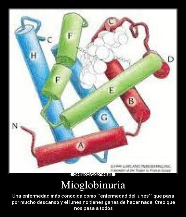 Mioglobinuria - 