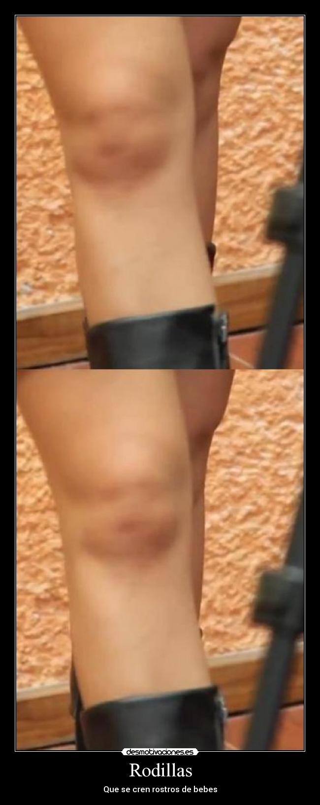 Rodillas - Que se cren rostros de bebes