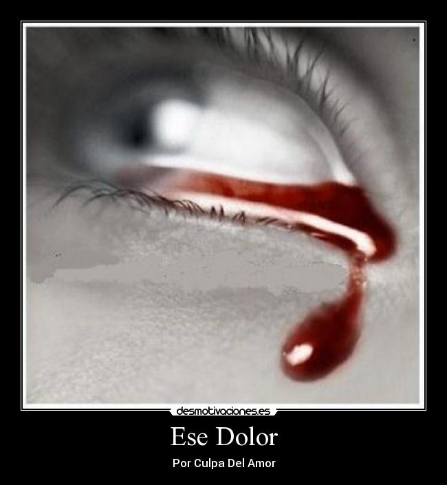 Ese Dolor - Por Culpa Del Amor