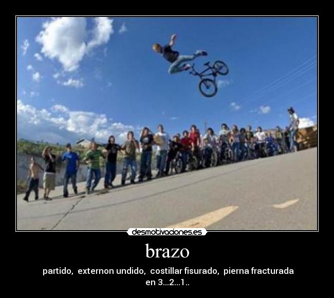 brazo -  partido,  externon undido,  costillar fisurado,  pierna fracturada
en 3...2...1..