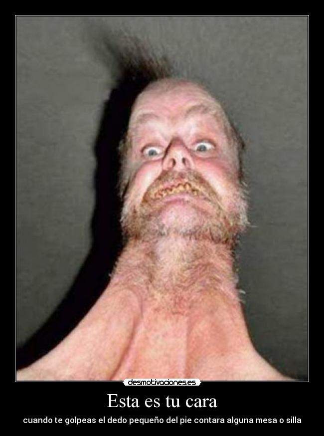 Esta es tu cara - cuando te golpeas el dedo pequeño del pie contara alguna mesa o silla