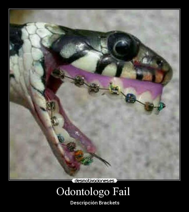 Odontologo Fail - Descripción Brackets