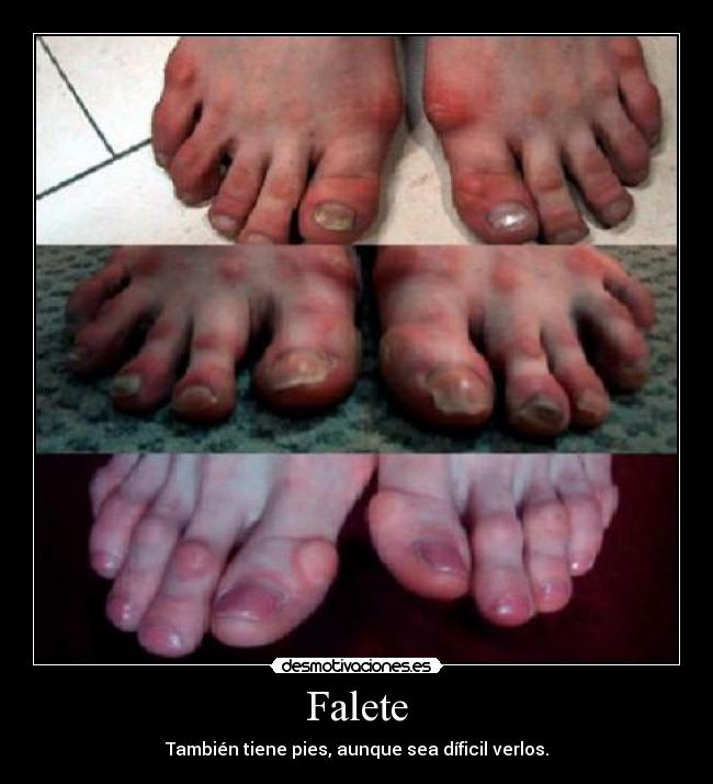 Falete - También tiene pies, aunque sea díficil verlos.