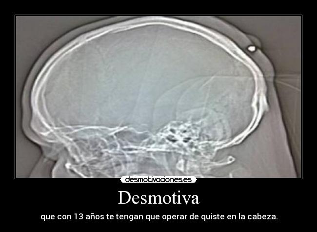 Desmotiva - 