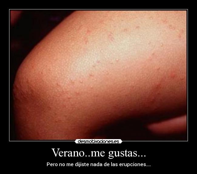 Verano..me gustas... - 