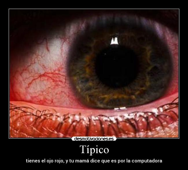 carteles ojo enrojecido desmotivaciones