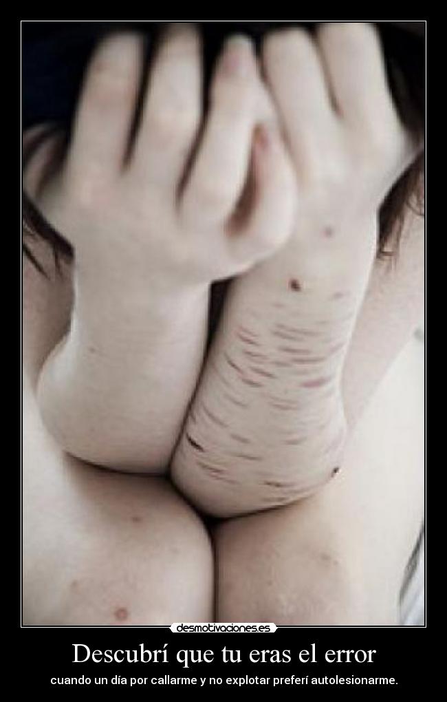 Descubrí que tu eras el error - cuando un día por callarme y no explotar preferí autolesionarme.