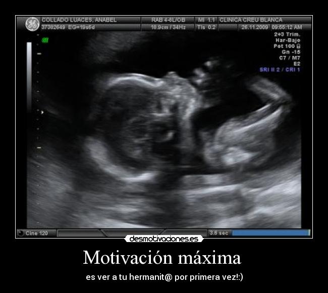 Motivación máxima  - es ver a tu hermanit@ por primera vez!:)