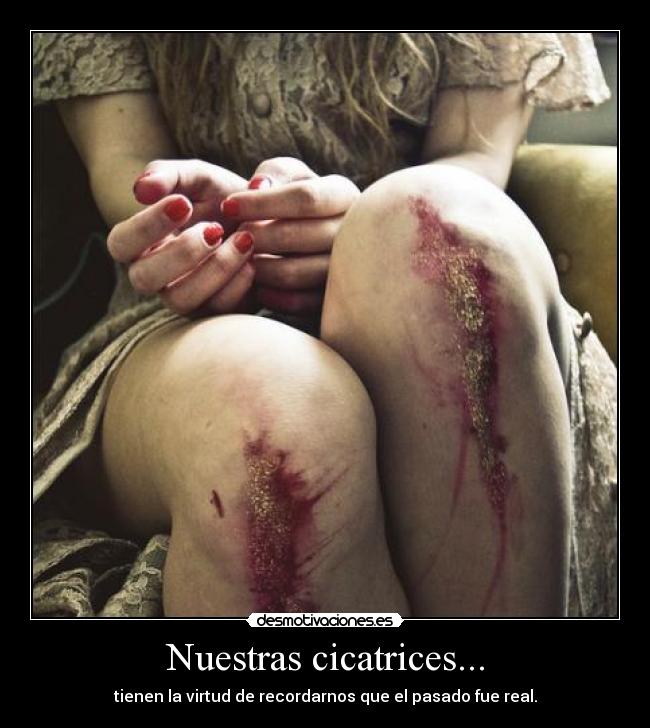 Nuestras cicatrices... - tienen la virtud de recordarnos que el pasado fue real.