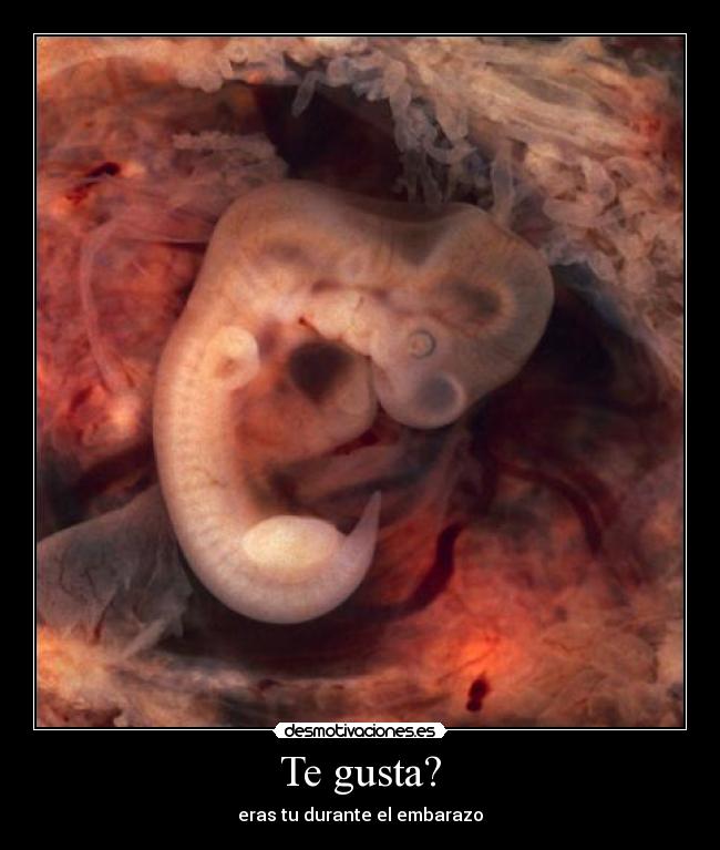 Te gusta? - eras tu durante el embarazo