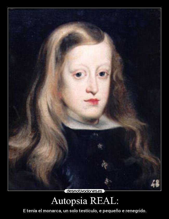 Autopsia REAL: - E tenía el monarca, un solo testículo, e pequeño e renegrido.