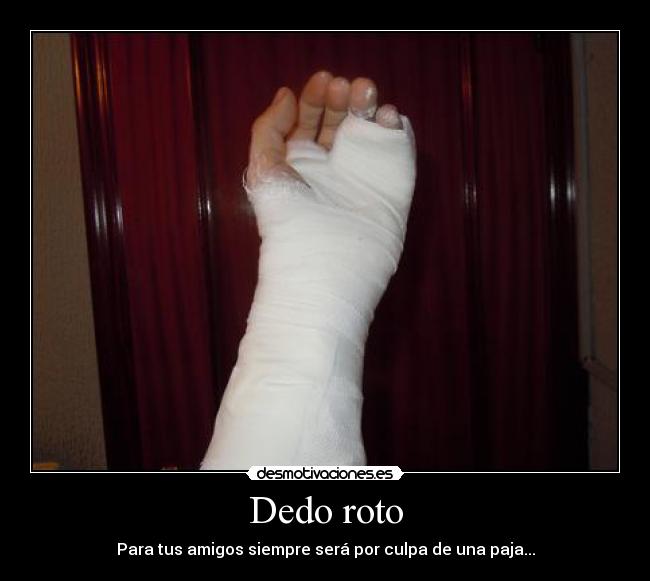 Dedo roto -
