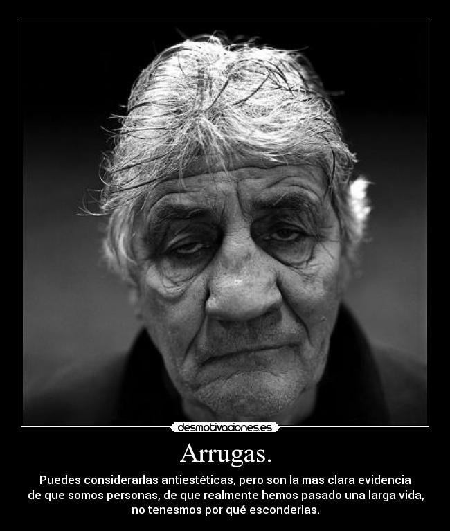 Arrugas. - 