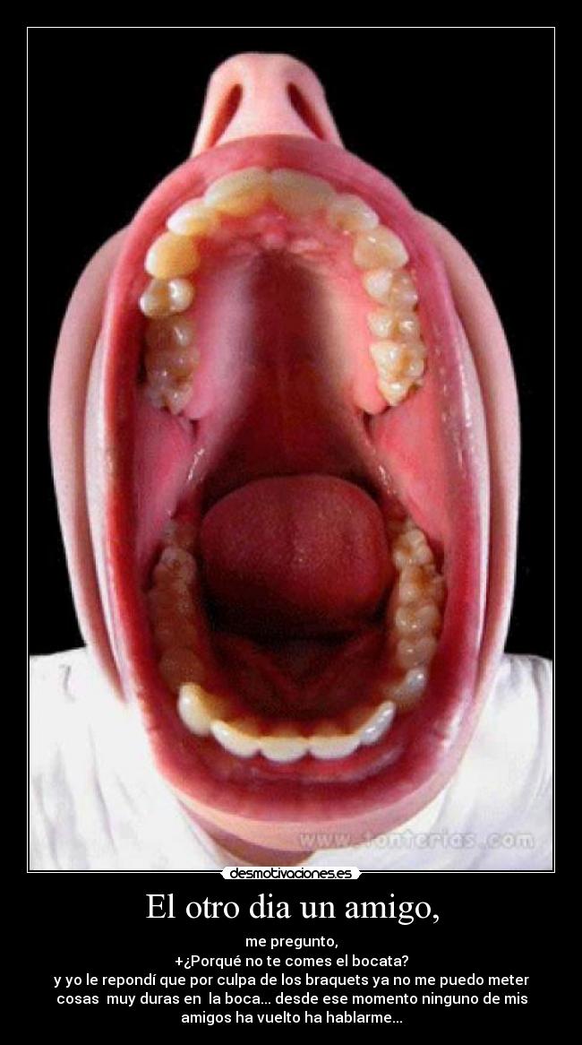 El otro dia un amigo, -