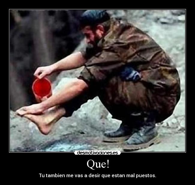 Que! - Tu tambien me vas a desir que estan mal puestos.