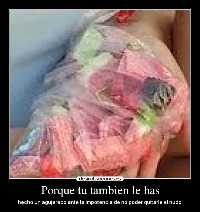 Porque tu tambien le has - hecho un agujeraco ante la impotencia de no poder quitarle el nudo.