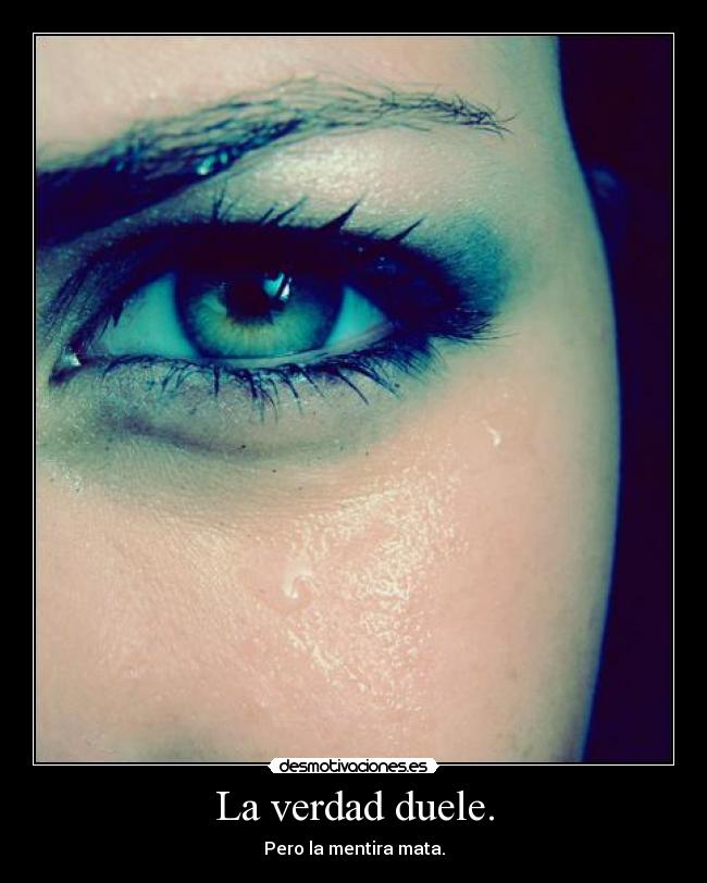 La verdad duele. -