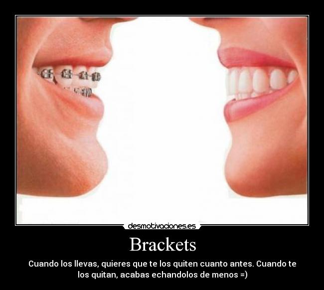 Brackets - Cuando los llevas, quieres que te los quiten cuanto antes. Cuando te
los quitan, acabas echandolos de menos =)