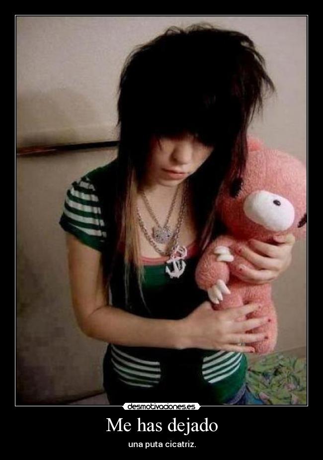 Me has dejado - una puta cicatriz.