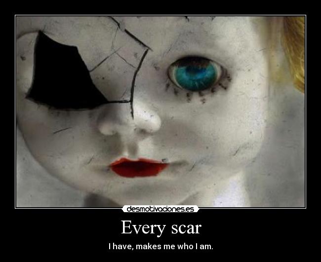 Every scar -