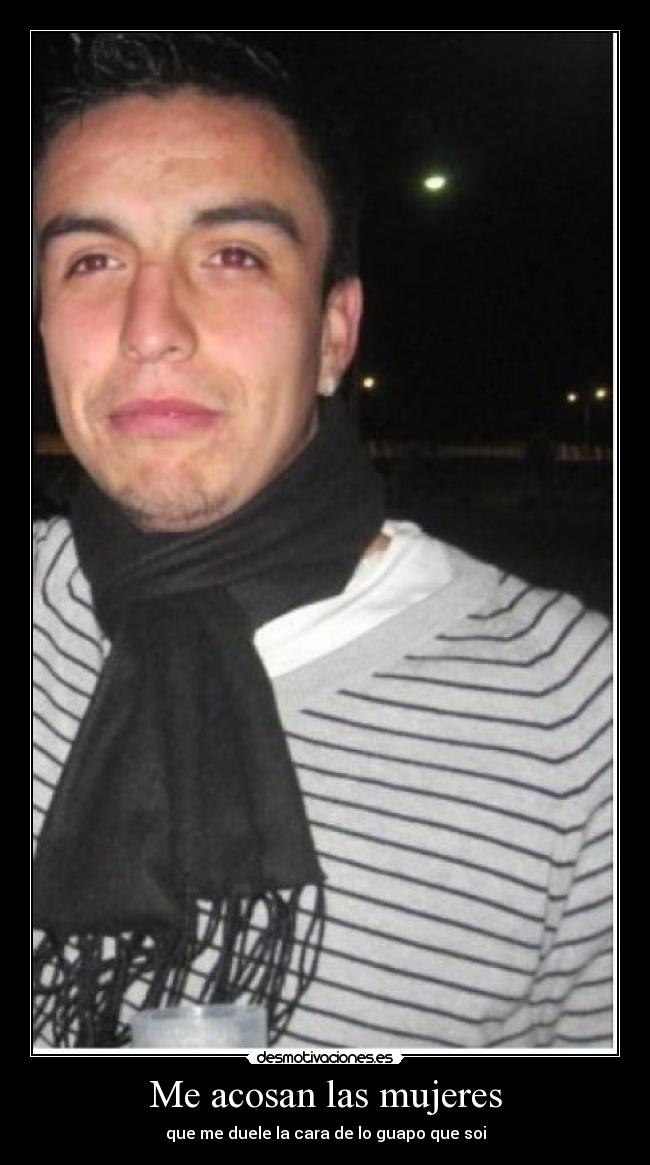 Me acosan las mujeres - que me duele la cara de lo guapo que soi