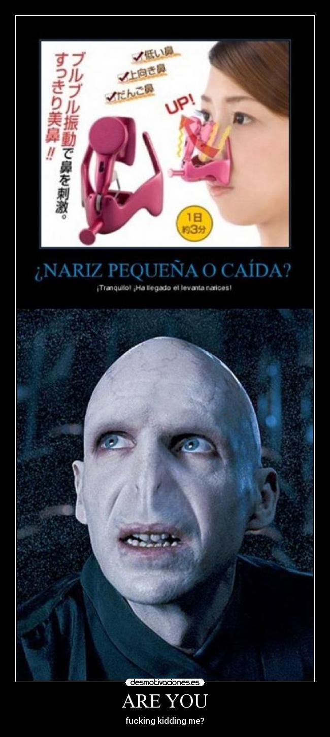 ARE YOU - fucking kidding me?