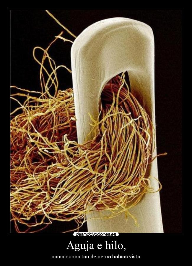 Aguja e hilo, - 